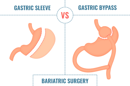 Gastric