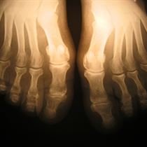 Bone Marrow Centre