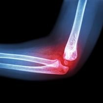 Orthopédie et Traumatologie