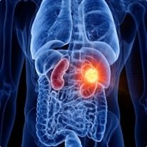 Urologie